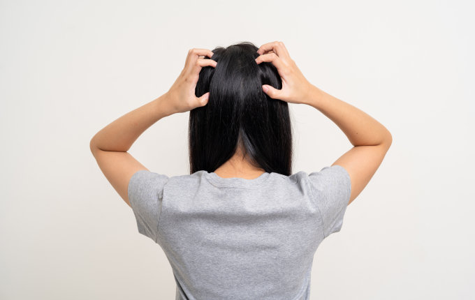 8款頭皮敏感洗頭水推薦！一次過止頭痕/去頭皮/減少頭油及泛紅+拆解頭皮敏感原因