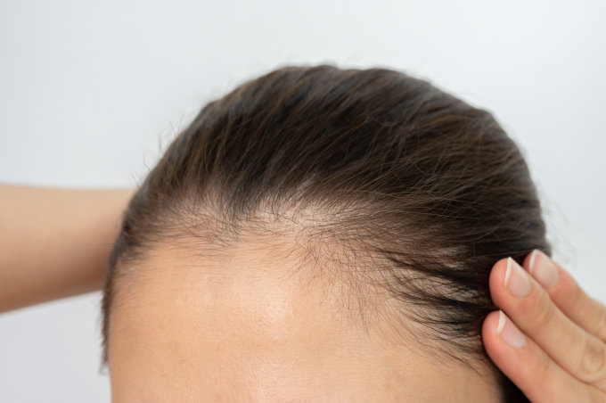 8款頭髮蓬鬆洗髮精推薦！解決頭髮細軟扁塌兼強健髮根+拆解頭髮扁塌的原因